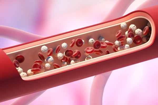 慢性淋巴細(xì)胞白血病